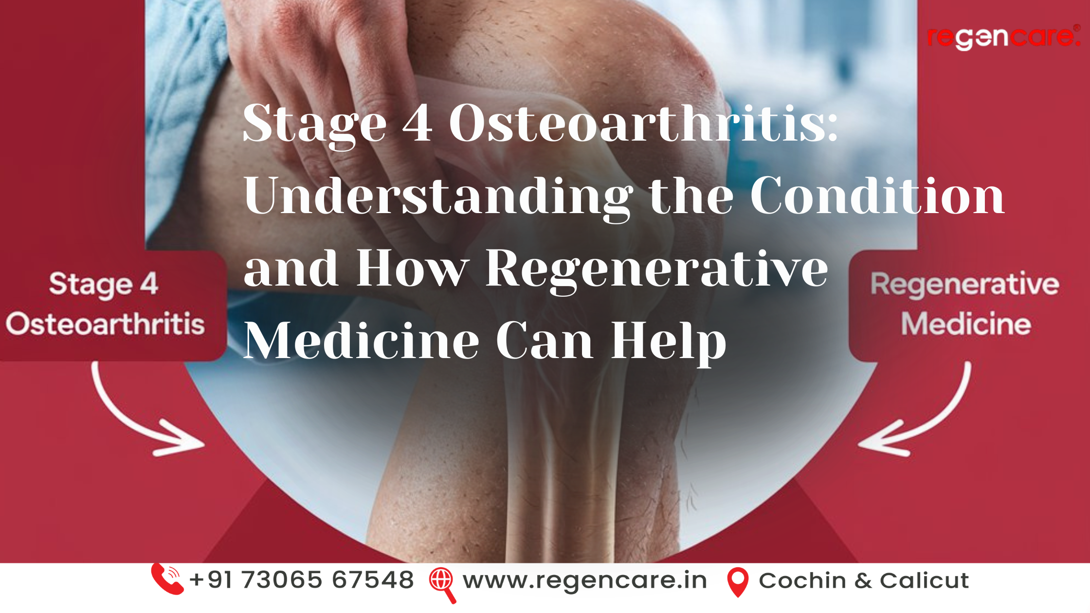 Is PRP Therapy Right for My Rheumatoid Arthritis